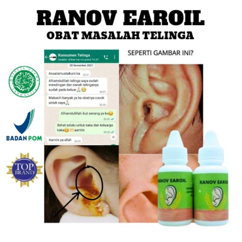 Chita Oil Penghilang Benjolan, Lipoma, Gondok Tanpa Operasi | CHITA OIL 20 ML | Penghilang Benjolan