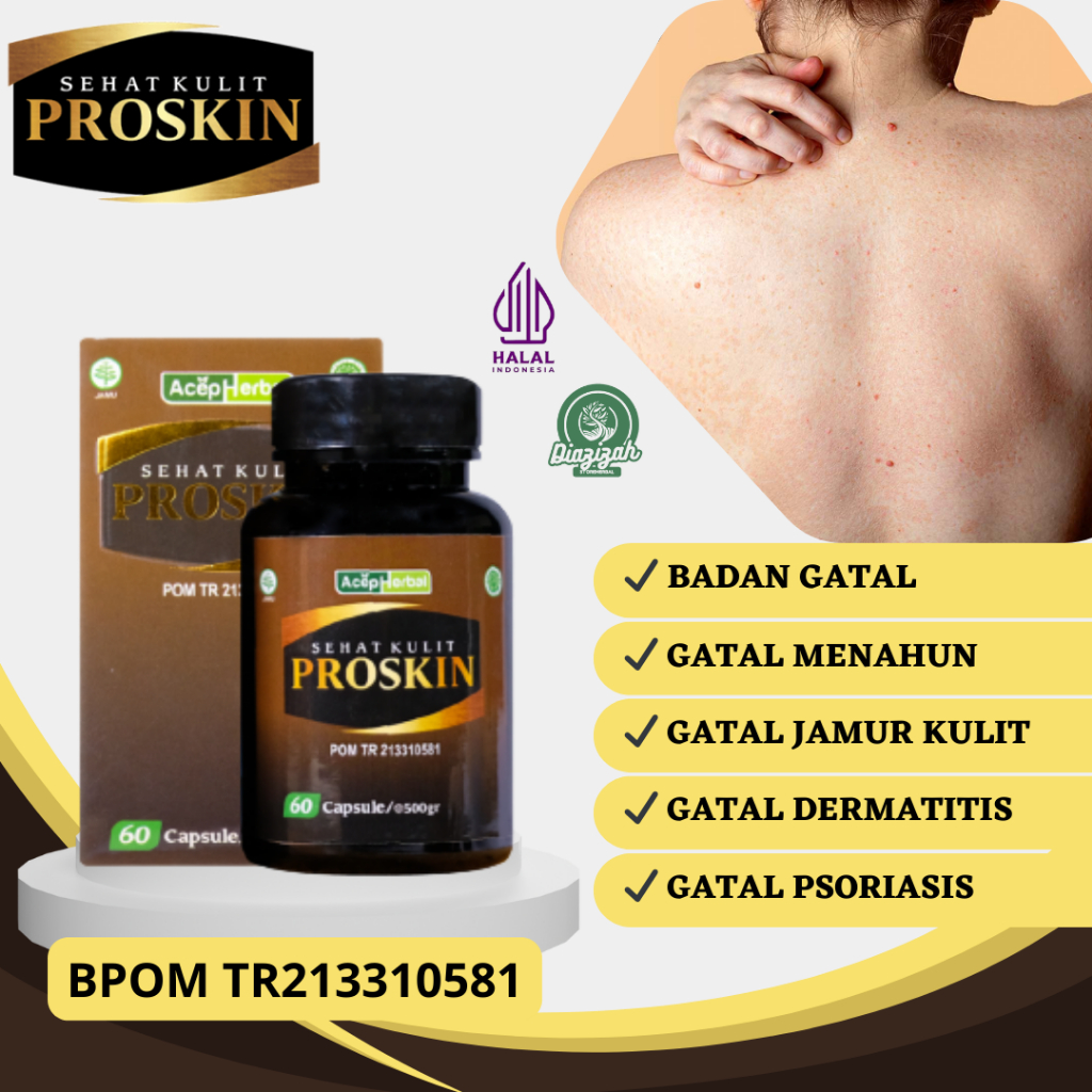 Obat Gatal di Badan, Obat Gatal Eksim, Obat Gatal Menahun, Obat Gatal Kulit, Obat Kurap, Obat Gatal 