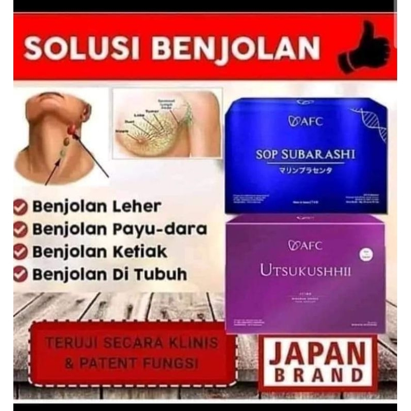 sop subarashi utshukushi