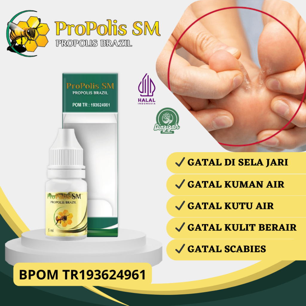 Obat Gatal di Sela Sela Jari, Obat Gatal Kulit Berair di Sela Sela Jari Tangan/Kaki, Obat Gatal Bera