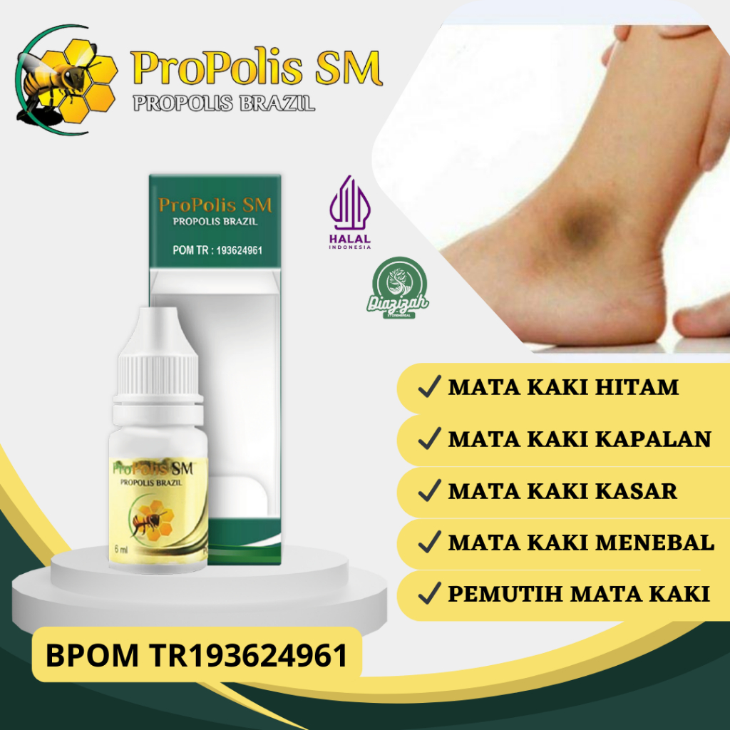Obat Mata Kaki Hitam dan Kasar, Obat Mata Kaki Hitam dan Kapalan, Obat Oles Mata Kaki Hitam, Obat Pe