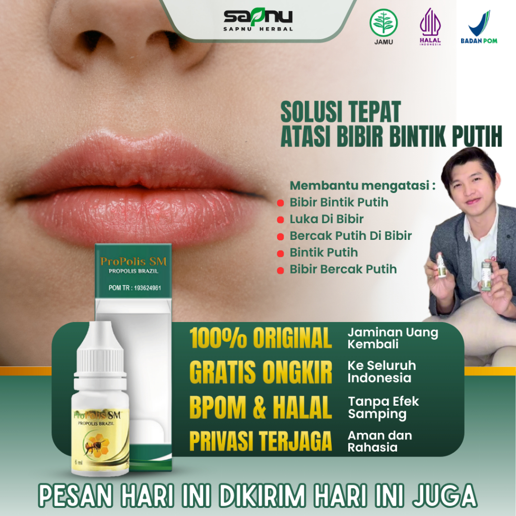 Propolis SM Obat Penghilang Bintik Putih di Bibir, Fordyce Spots, Bintik Putih di Bibir, Obat Bercak