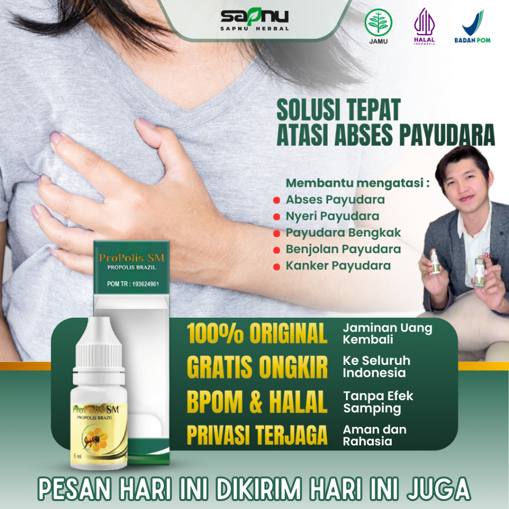 Propolis SM Obat Benjolan Di Payudara, Payudara Sering Nyeri, Payudara Sakit Saat Di Tekan, Penghanc