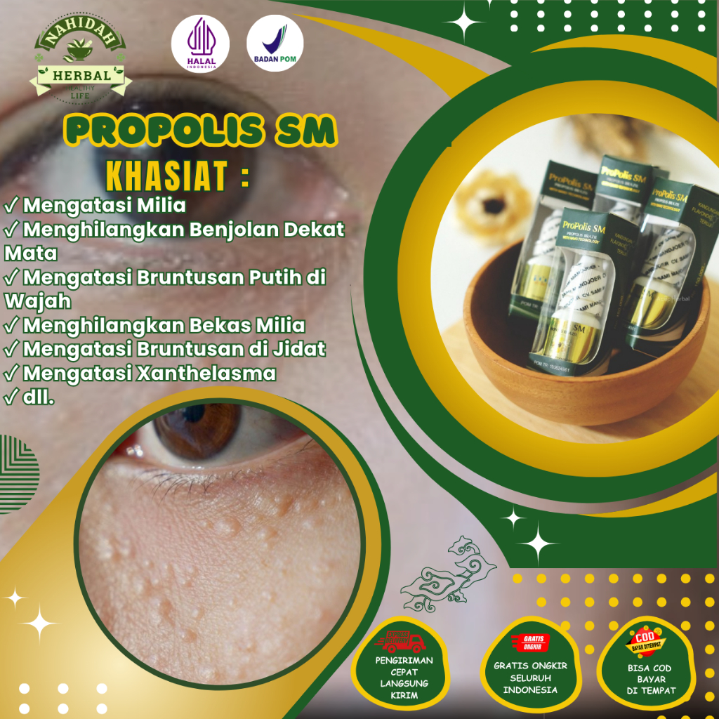 Obat Milia, Obat Penghilang Milia, Bruntusan Bawah Mata, Obat Penghilang Bekas Bruntusan Milia, Benj