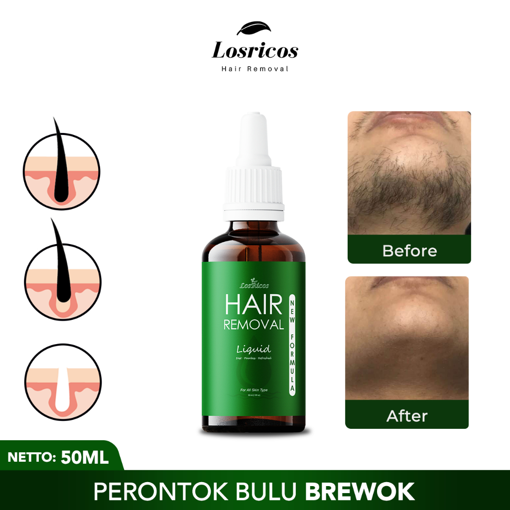 Perontok Bulu Brewok Permanen Losricos Hair Removal Penghilang Bulu Jenggot dan Kumis BPOM