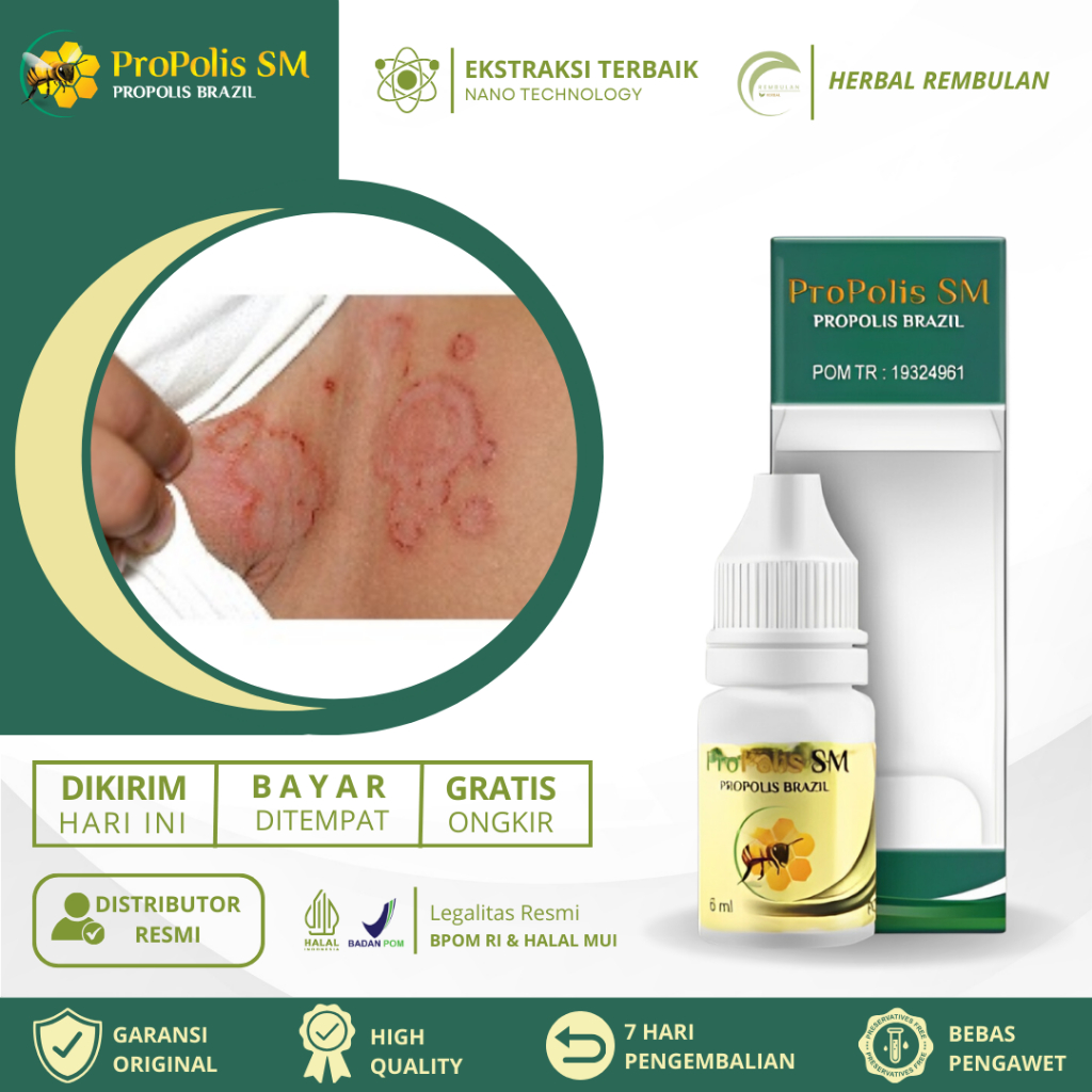 Obat Gatal Selangkangan, bat Selangkangan Hitam dan Gatal, Obat Candida Albicans, Obat Infeksi Jamur