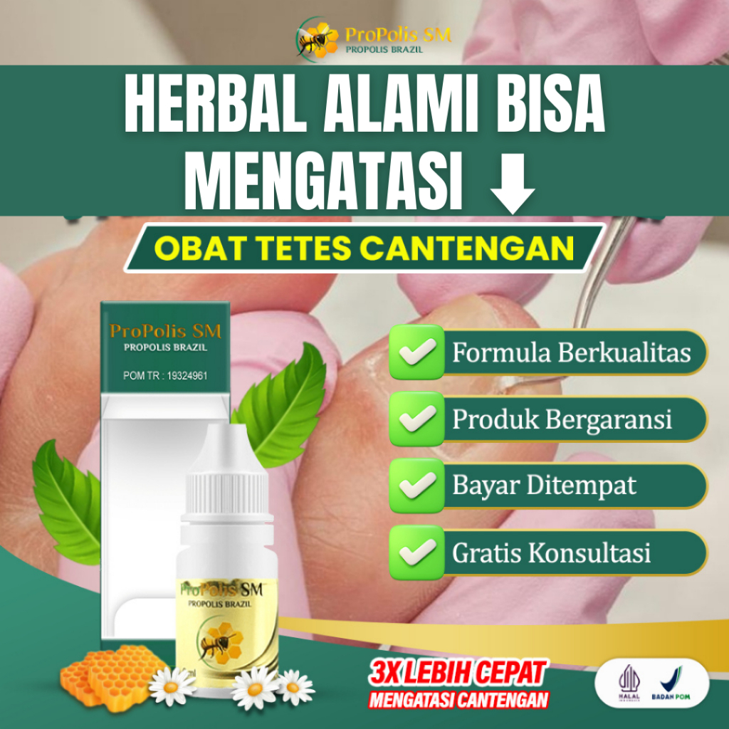 Obat Tetes Cantengan Jempol Kaki Jempol Kuku Kaki Busuk Bernanah Bau Kuku Rusak - Propolis SM Asli