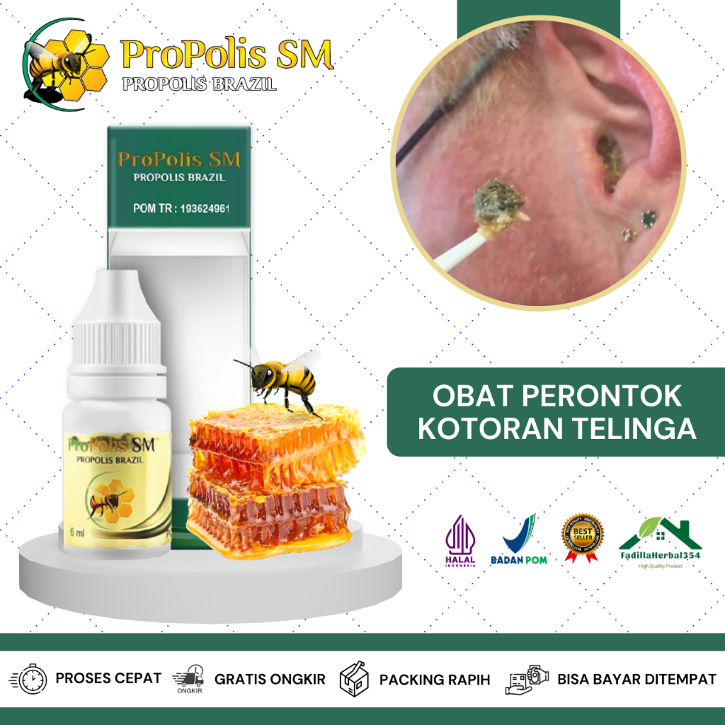 Obat Tetes Telinga Kotor, Obat Pelunak Kotoran Telinga, Obat Kotoran Telinga Keras, Obat Penghancur 