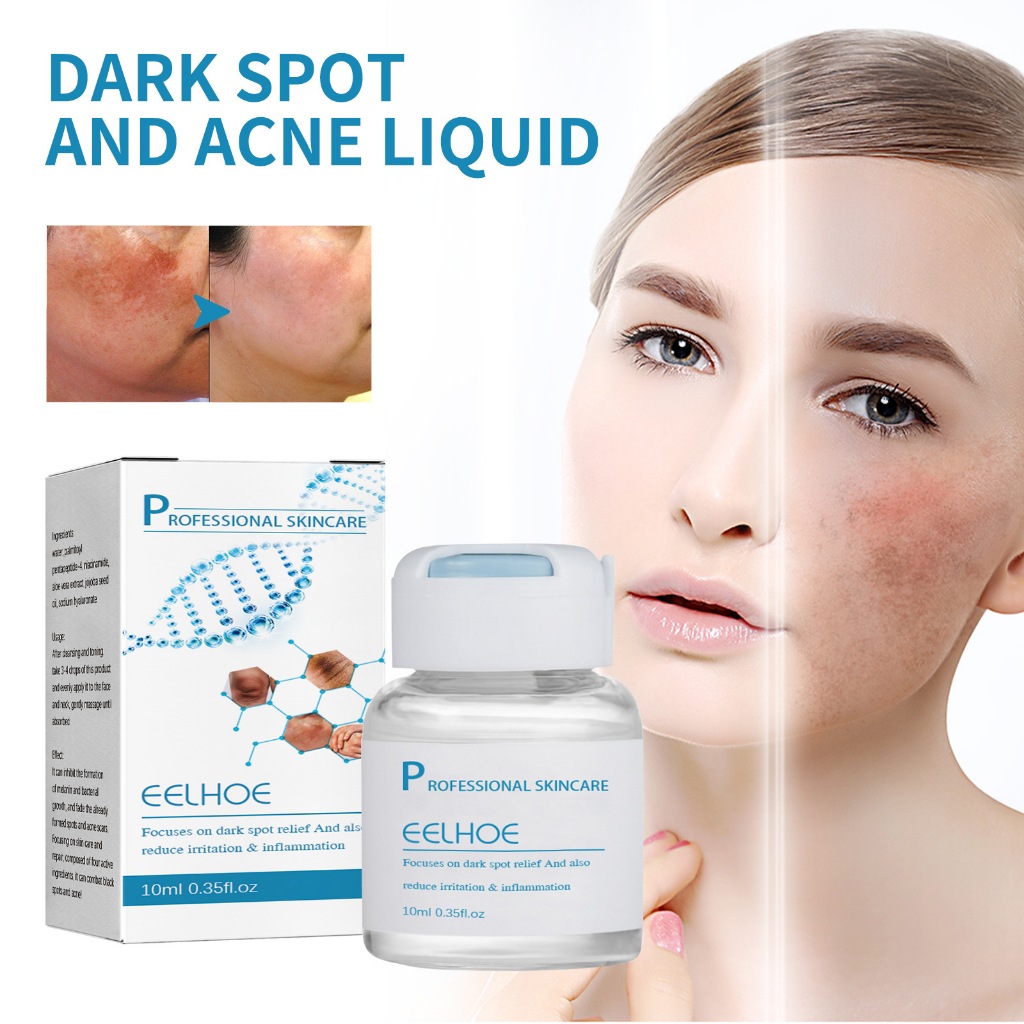 EELHOE Serum Pengurang Bintik Hitam Menghidrasi & Melembabkan Pengurangan Noda Bintik-bintik Gelap M