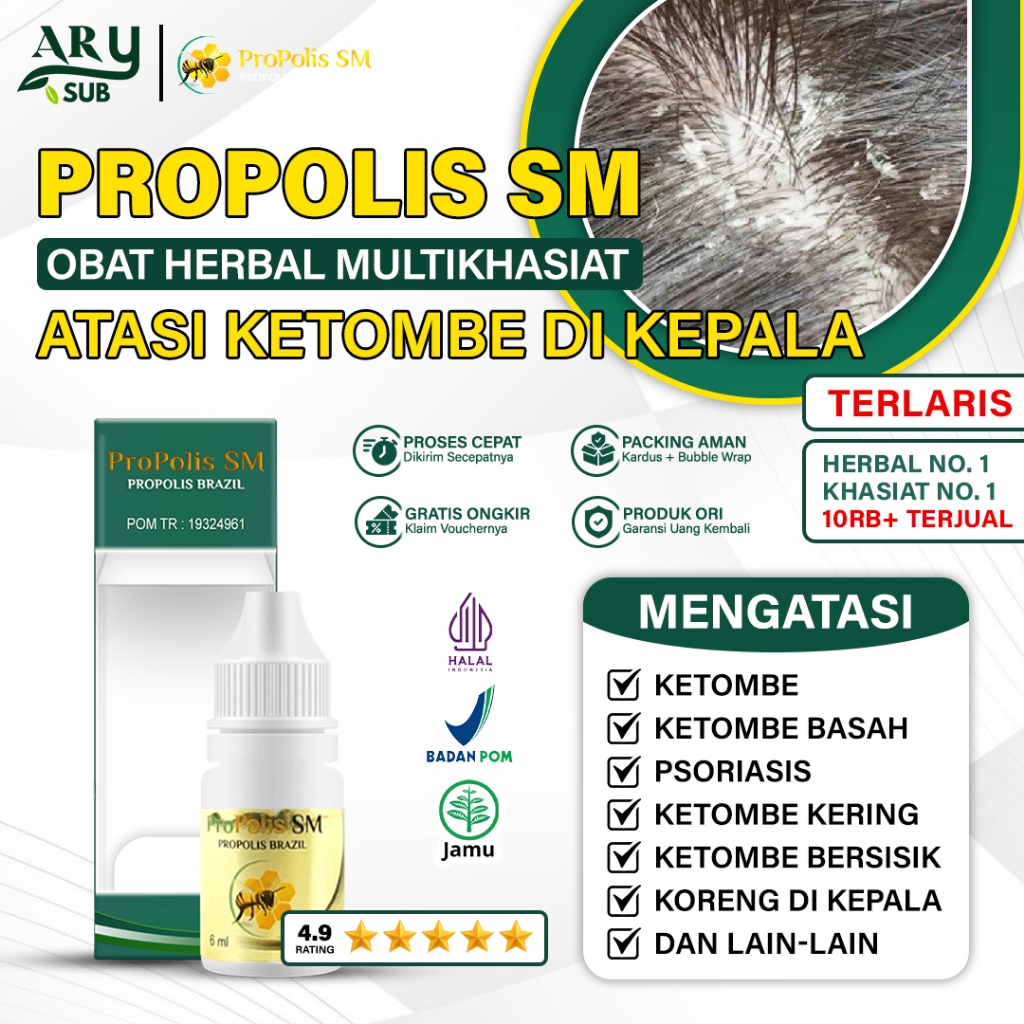 Obat Ketombe Di Kepala - Ketombe Rambut - Ketombe Kulit Kepala Kering - Ketombe Akut Propolis SM