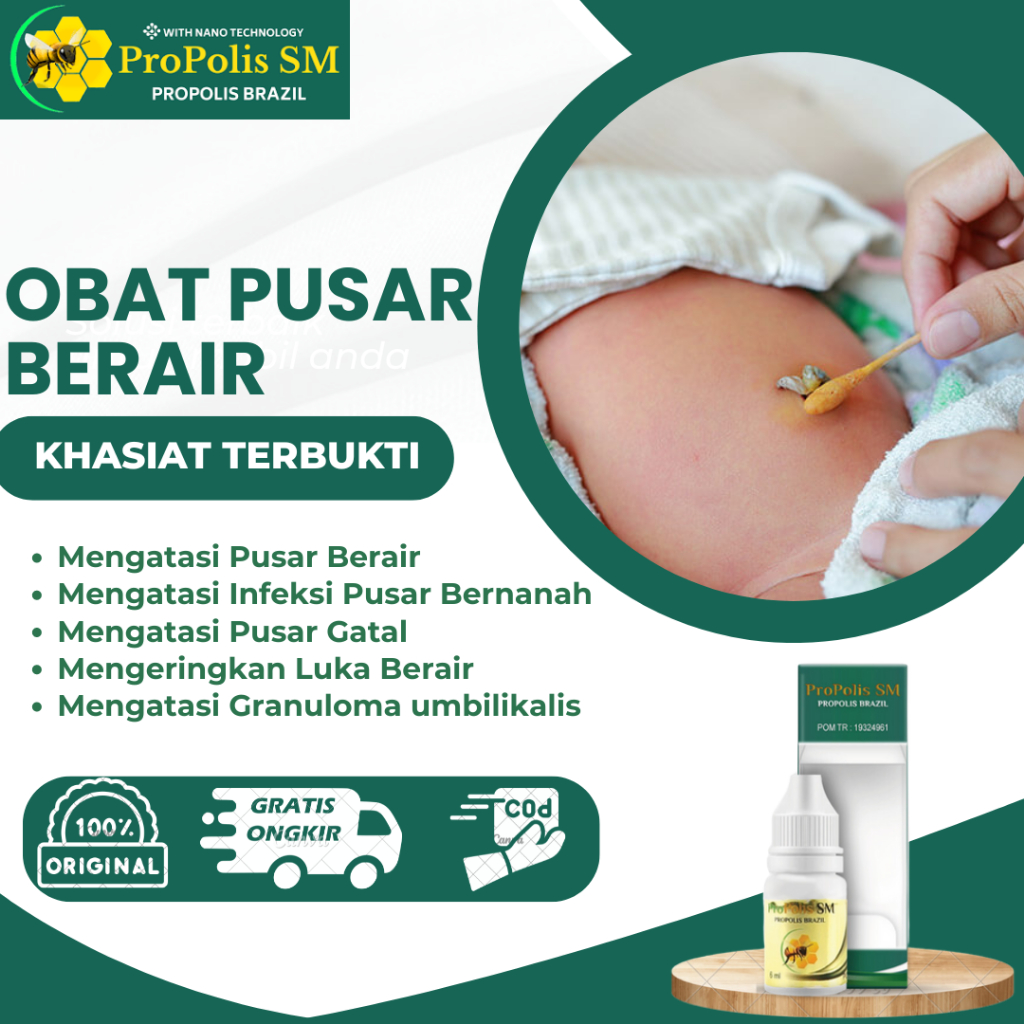 Obat Pusar Berair, Infeksi Pusar Bernanah, Pusar Bayi Selalu Keluar Air, Granuloma umbilikalis, Pusa
