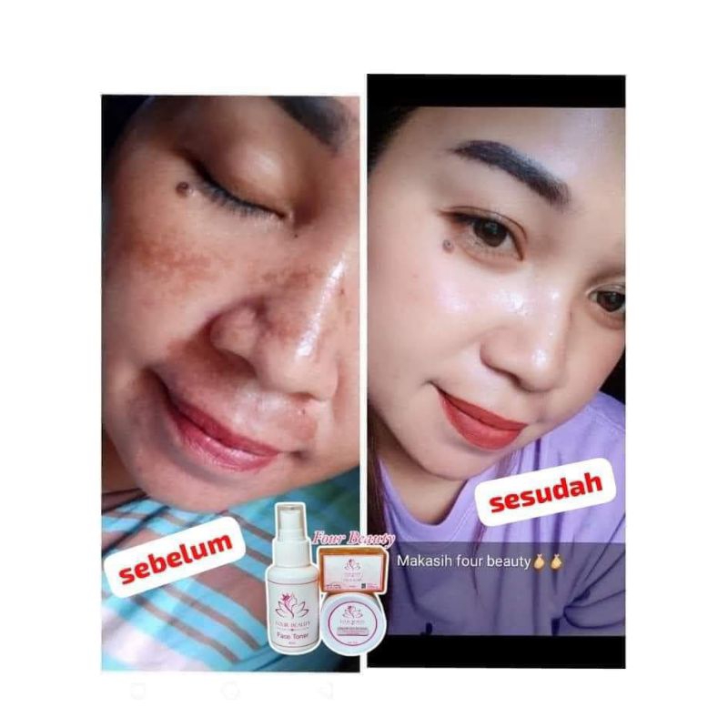 

FOUR BEAUTY SKINCARE BPOM ✅