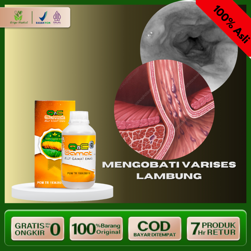 OBAT VARISES LAMBUNG - VARISES ESOFAGUS - QNC JELLY GAMAT ASLI BERKHASIAT