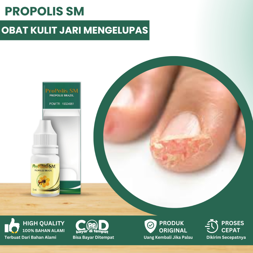 Obat Kulit jari mengelupas,Jari Tangan Kering, Obat Jari Tangan Kering Pecah Pecah, Obat Jari Tangan