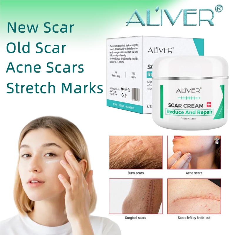 ALIVER Scar Cream Penghilang Bekas Jerawat Kemerahan Kehitaman Krim Salep Bekas Jerawat Obat Penghil