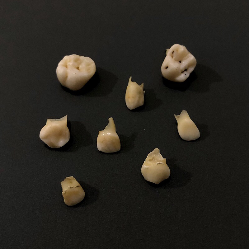 Gigi Asli Incisor Molar Decidui / Gigi Geraham Anak Susu Praktikum Tanpa Akar