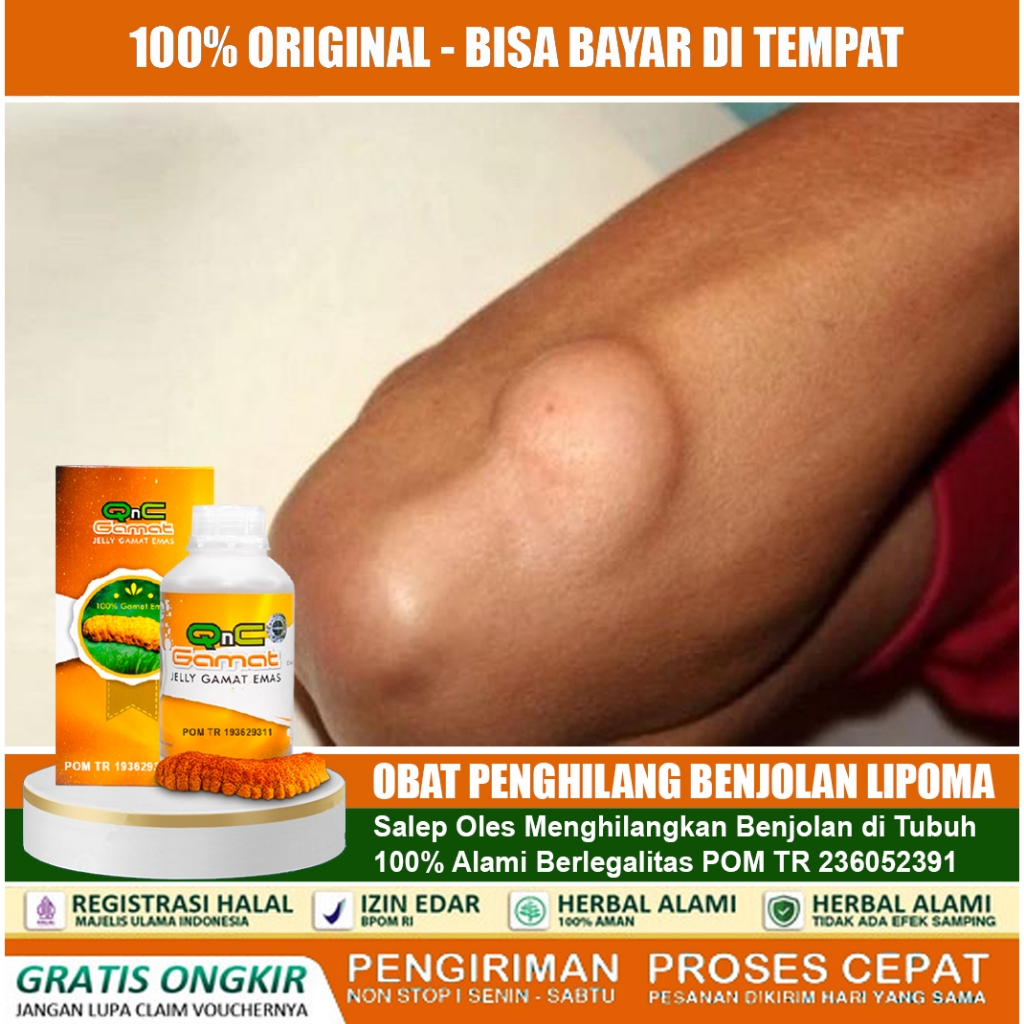 Obat Benjolan Lipoma Krim salep Oles Benjolan di Leher, Tangan, Ketiak, Punggung Pundak, Kaki Selang