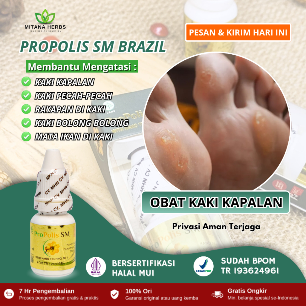 Obat Kaki Kapalan , Salep Kapalan Kaki, Obat Kaki Pecah-Pecah, Salep Kaki Rayapan Bolong