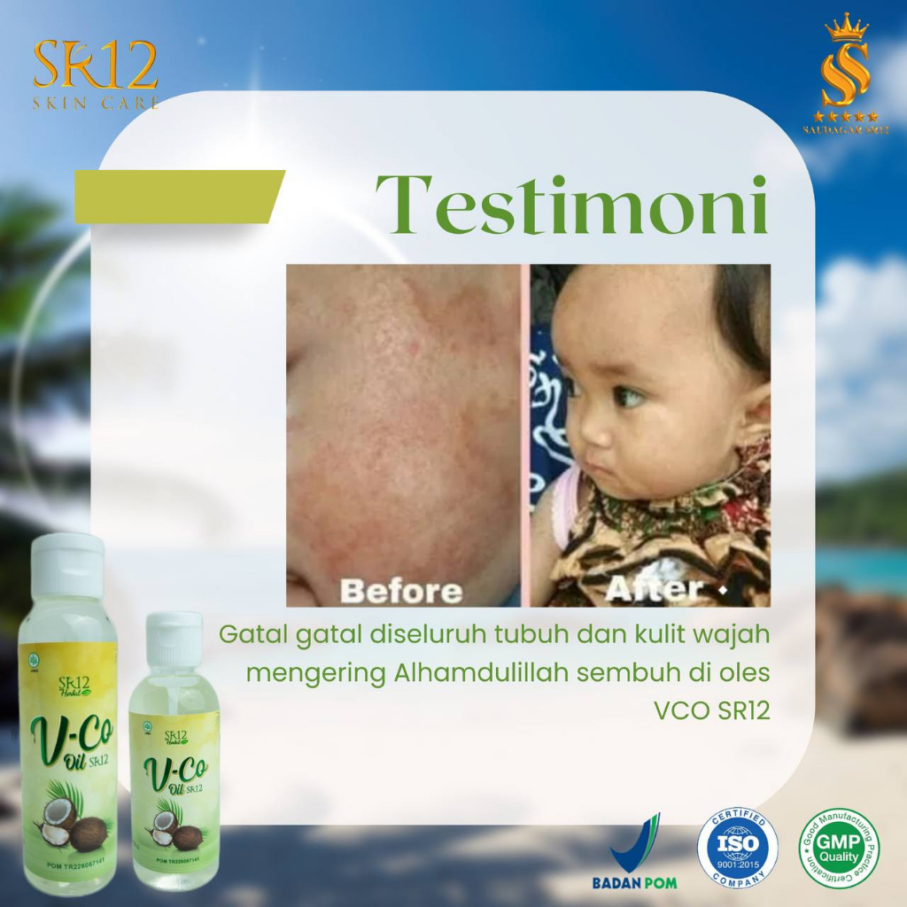 Ay00 Obat Oles untuk Ruam Pipi dan Ruam pada Popok Bayi Leher Merah Atasi Biang Keringat