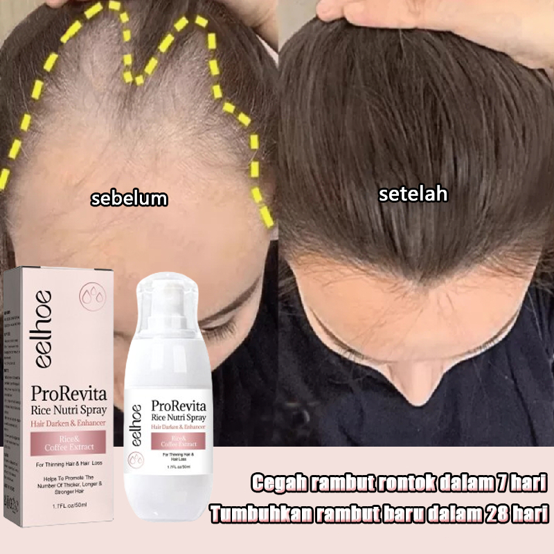 Serum penumbuh rambut Penebal Rambut anti rontok rambut penumbuh rambut botak perawatan rambut ronto