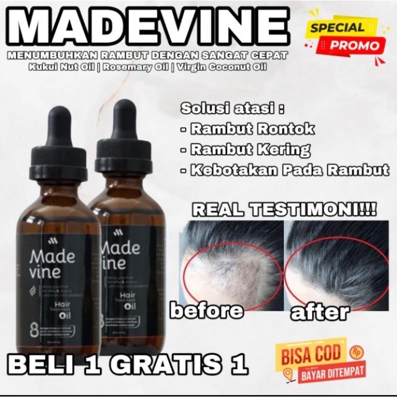 (BUY 1 GET 1) MADEVINE - Obat Serum Rambut Rontok dan Penumbuh Rambut Pria Wanita - Madevine Hair Oi