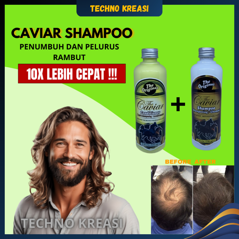 Penumbuh Dan Pelurus Rambut The Caviar Shampo Kuda Pemanjang Rambut Perawatan Penumbuh Penyubur Ramb