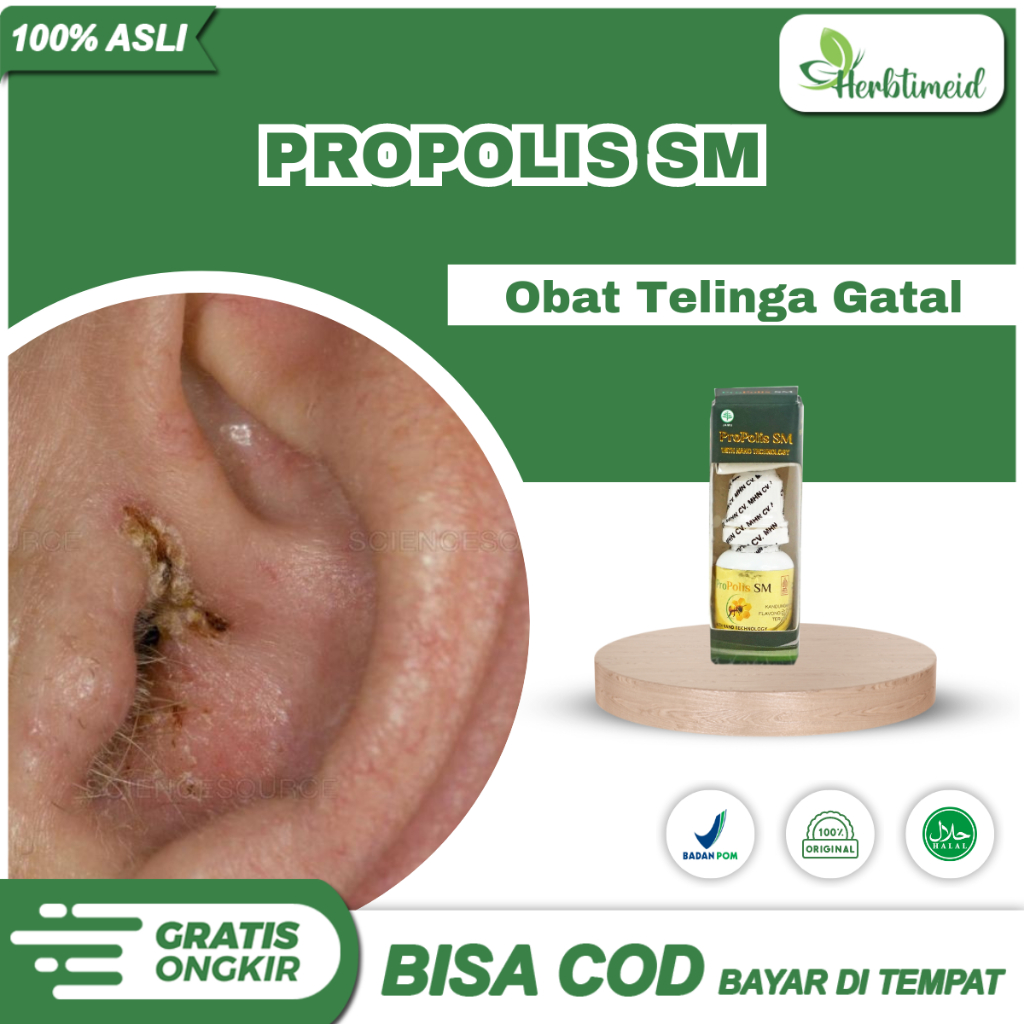 Obat Telinga Gatal Karena Jamur Kuping Berjamur Tetes Otomikosis - Propolis Sm