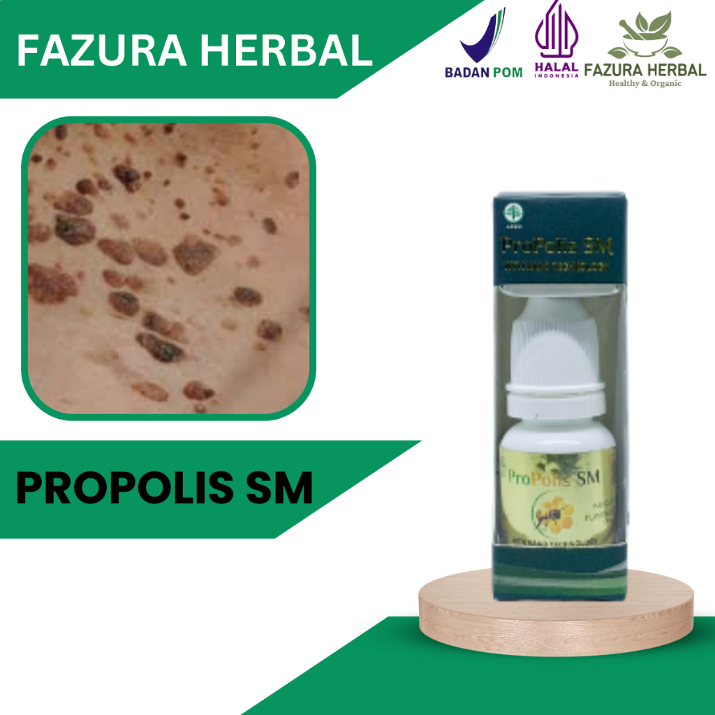 Propolis SM - Obat Kanker Kulit, Obat Oles Kanker Kulit, Obat Penghilang Bekas luka Kanker Kulit, Ob