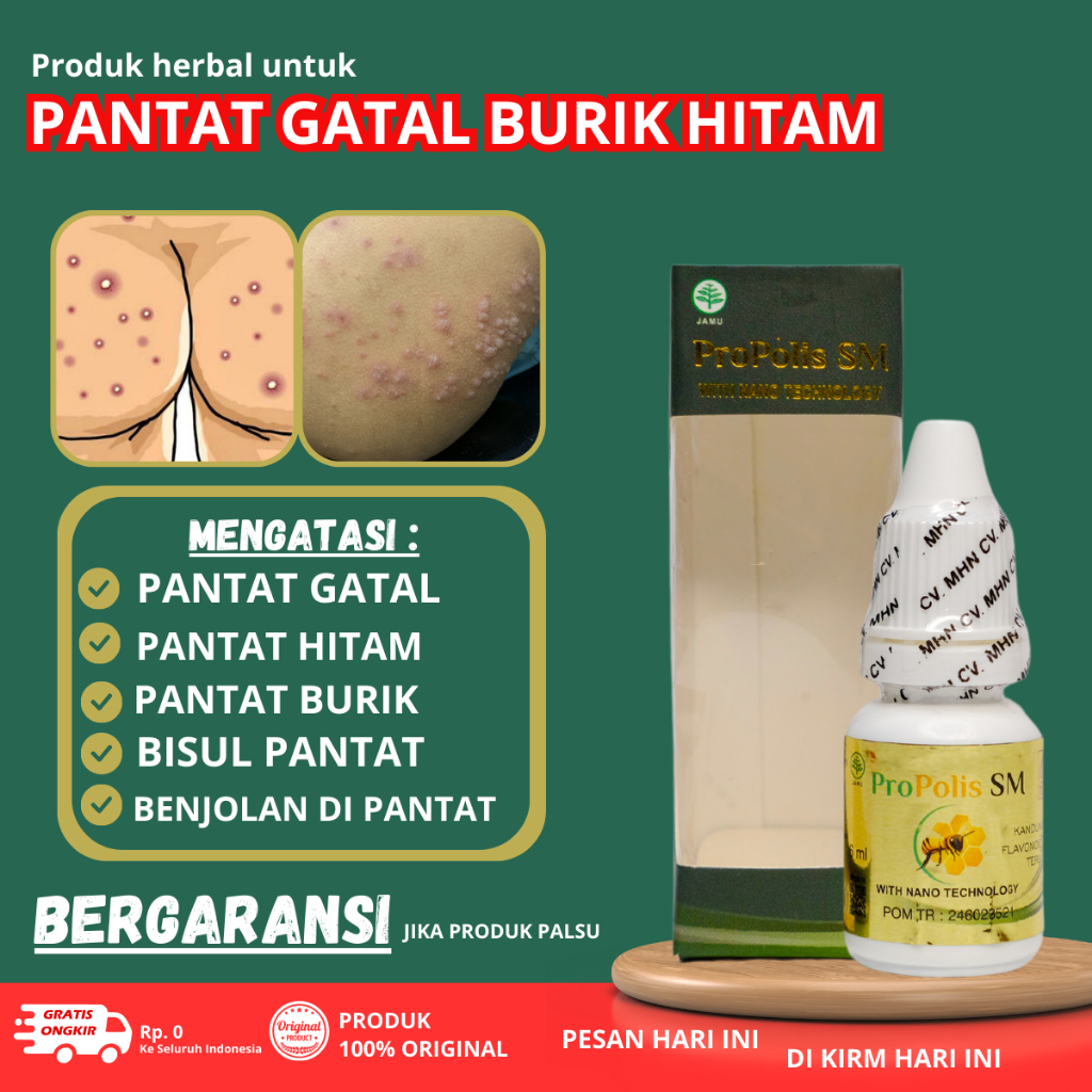 Obat Pantat Gatal - Obat Pantat Bruntusan - Obat Pantat Jamur - Obat Gatal Selangkangan - Obat Bokon