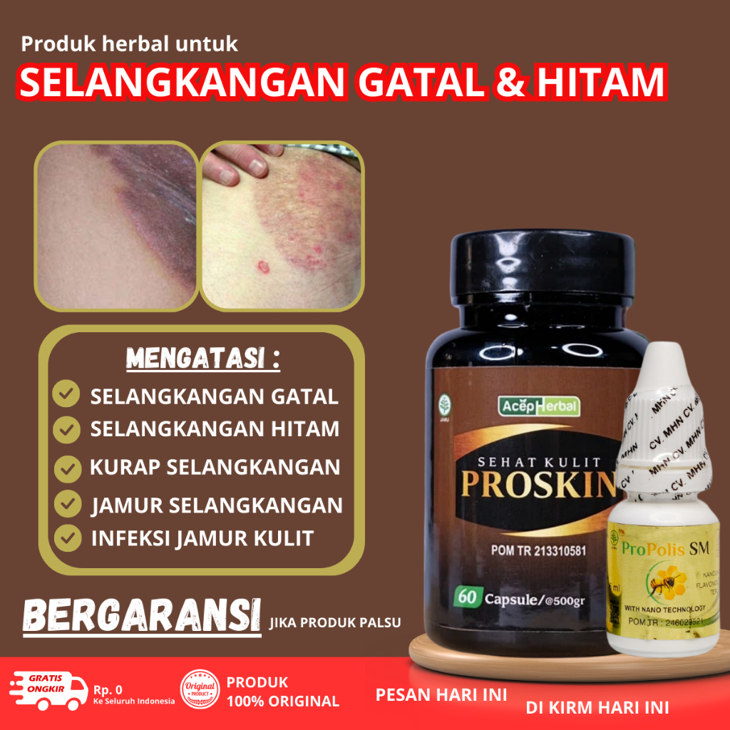 Salep Gatal Selangkangan - Salep Selangkangan gatal dan lecet - Obat Pantat Burik - Obat Pantat Gata