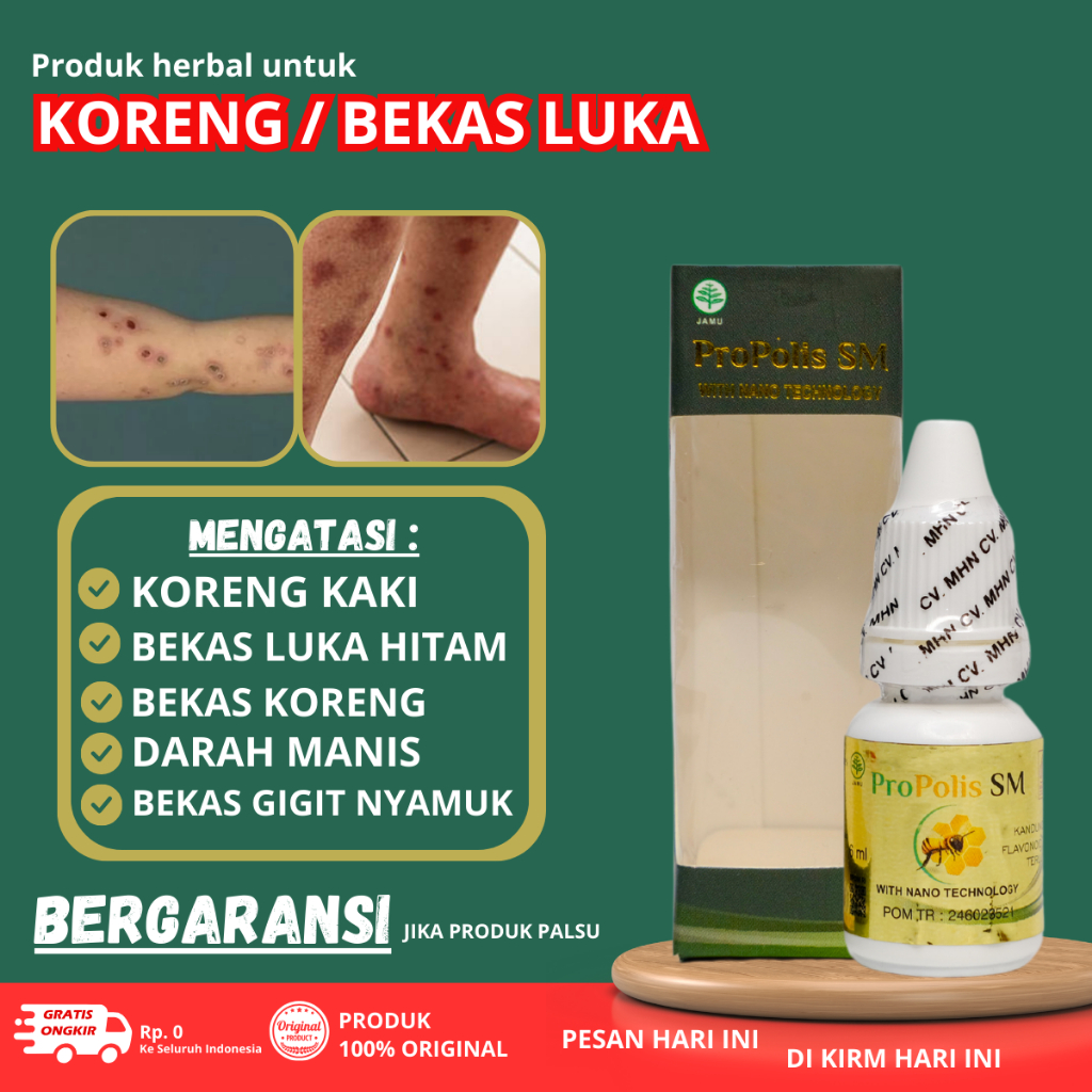Obat Luka Koreng, Obat Penghilang Bekas koreng, Obat Bekas luka, Obat koreng di kaki, Obat Koreng, O