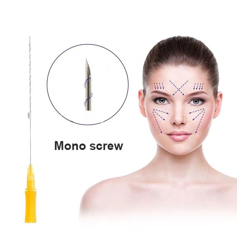 KODE Y79Q threadlift wajah benang mono screw tanam benang Kapal pada tanggal baru1pcs