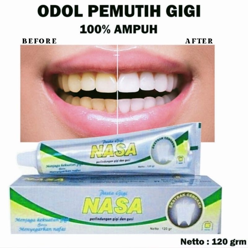 Pasta Gigi Nasa  Pasta Gigi Pemutih Nasa