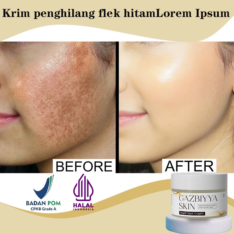 [BPOM]penghilang flek hitam membandel flek hitam di wajah membandel cream flek hitam membandel cream