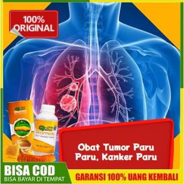 Obat Tumor Paru Paru, Kanker Paru , TBC Paru, Flek Paru | QnC Jelly Gamat