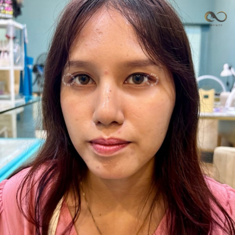 INFINITYLENSTORE • SOFTLENS BASIC NATURAL NO RING/TANPA RING NORMAL & MINUS