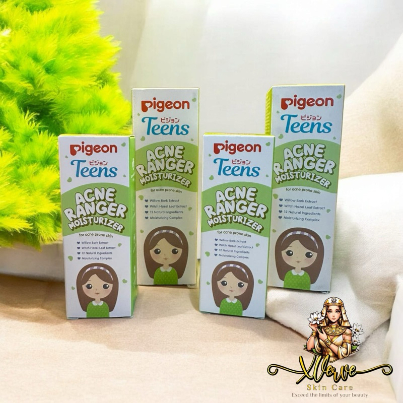 Pigeon Teens Acne Ranger Moisturizer || Moisturizer acne remeja