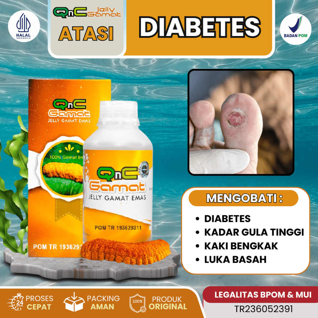 Obat Diabetes, Diabetes Kering, Obat Diabetes Basah, Obat Kaki Bengkak, Obat Kadar Gula Darah Tinggi