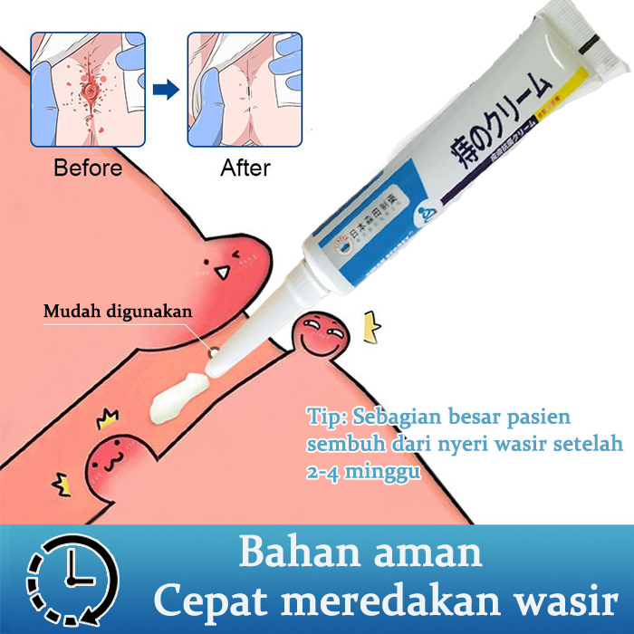 JAPAN Obat wasir Salep wasir Obat hemoroid 20G Salep obat wasir paling efektif Krim Wasir Herbal Pre