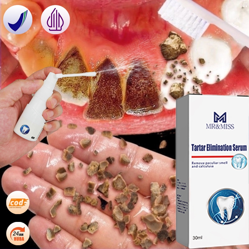 Perontok karang gigi paling ampuh Pembersih karang gigi Penghilang karang gigi 30ml Perontok karang 