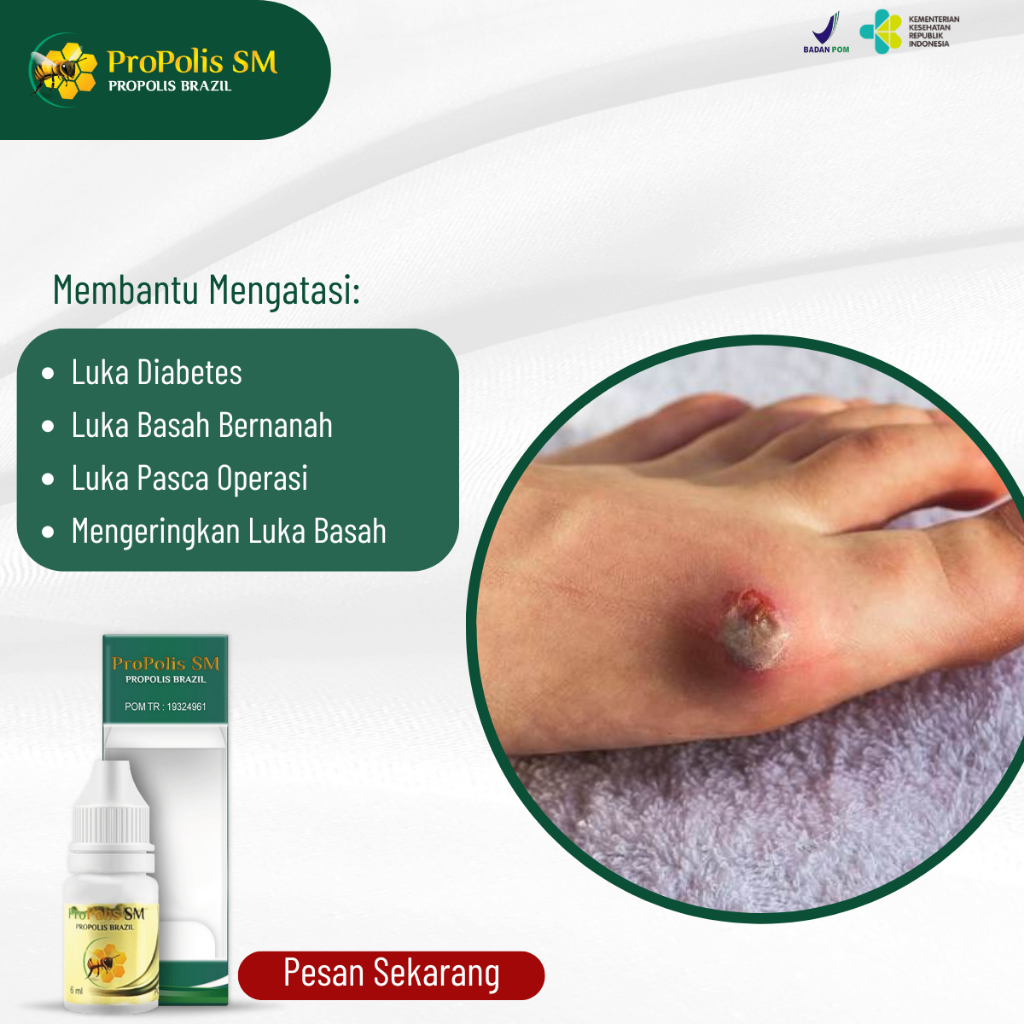 Obat Luka Diabetes Basah, Obat Luka Diabetes Kering, Obat Luka Basah, Obat Luka Pasca Operasi, Obat 