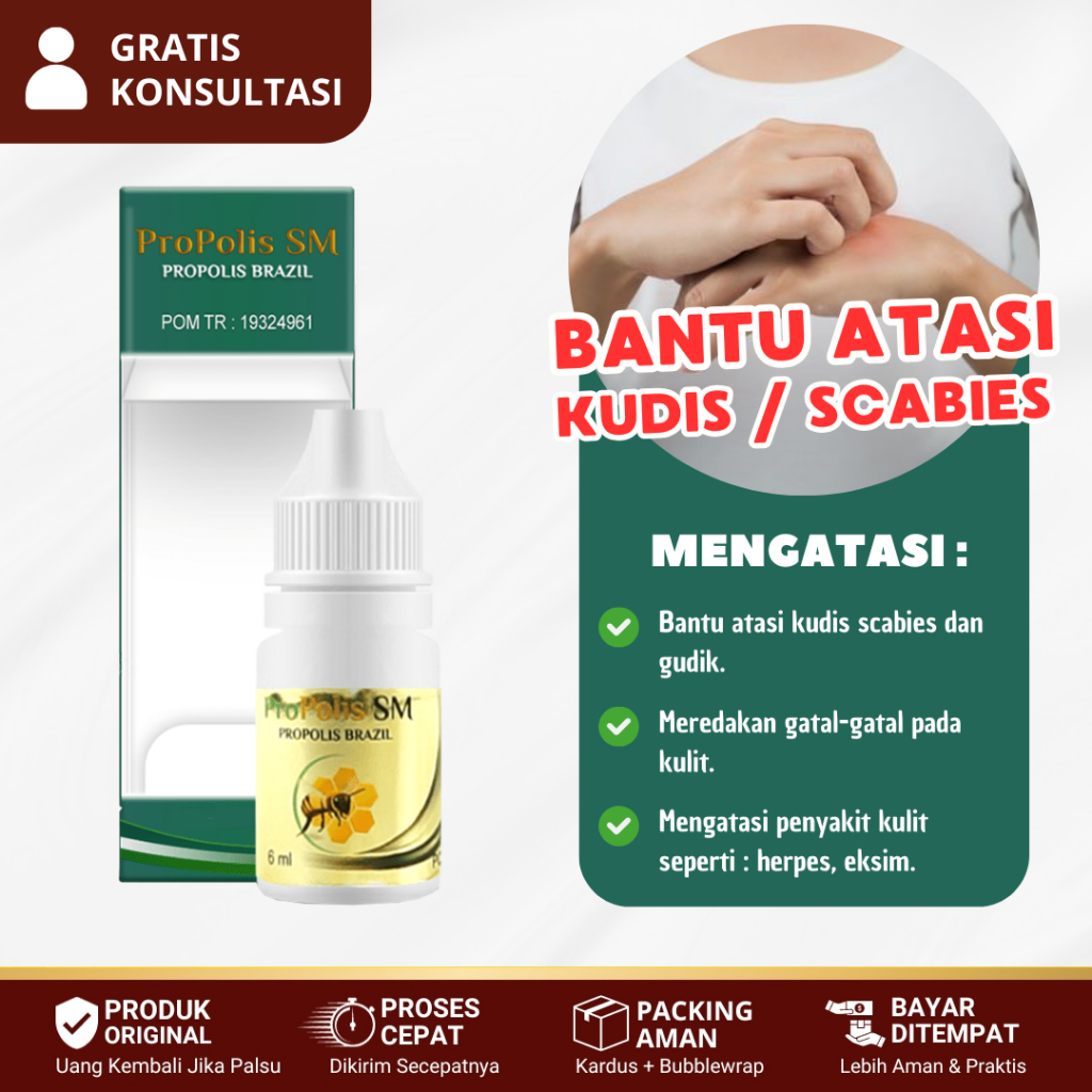 Obat Kudis Anak Dan Dewasa, Gatal Kudis, Scabies Manusia, Obat Oles Scabies, Gudig - Propolis SM