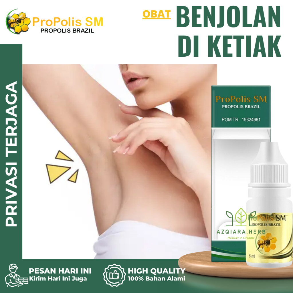 Obat Benjolan Di Ketiak, Obat Pengempis Benjolan Di Ketiak, Obat Benjolan Di Leher, Obat Benjolan Di