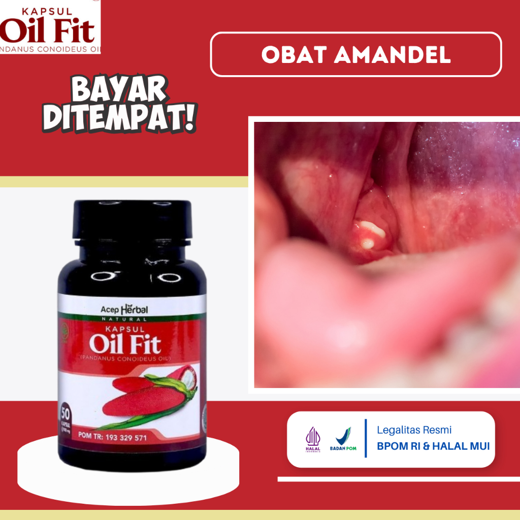 obat Amandel, Obat Radang Amandel, Obat Tonsillitis, Obat Amandel Bengkak, Obat Pembengkakan Amandel