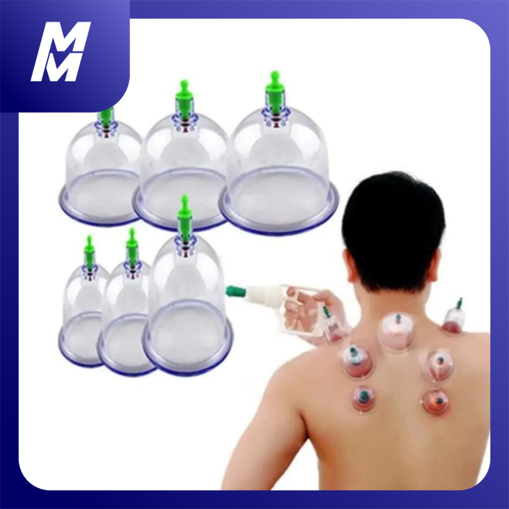 Kop Angin Nikita Murah Alat Bekam 6 Tabung Terapi Alami Masuk Angin