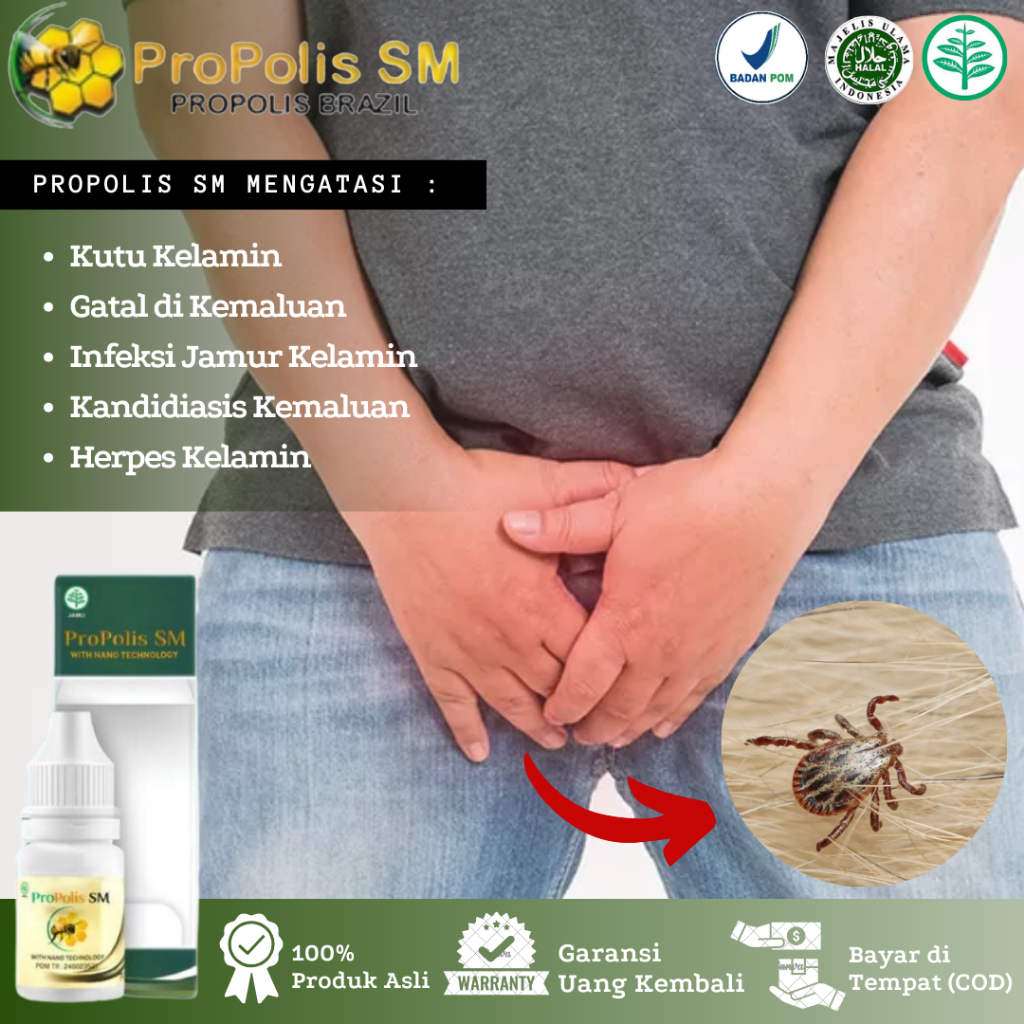 Obat Penghilang Kutu Kemaluan, Gatal Rambut Kemaluan, Infeksi Jamur Kelamin, Gatal Kemaluan, Obat Te