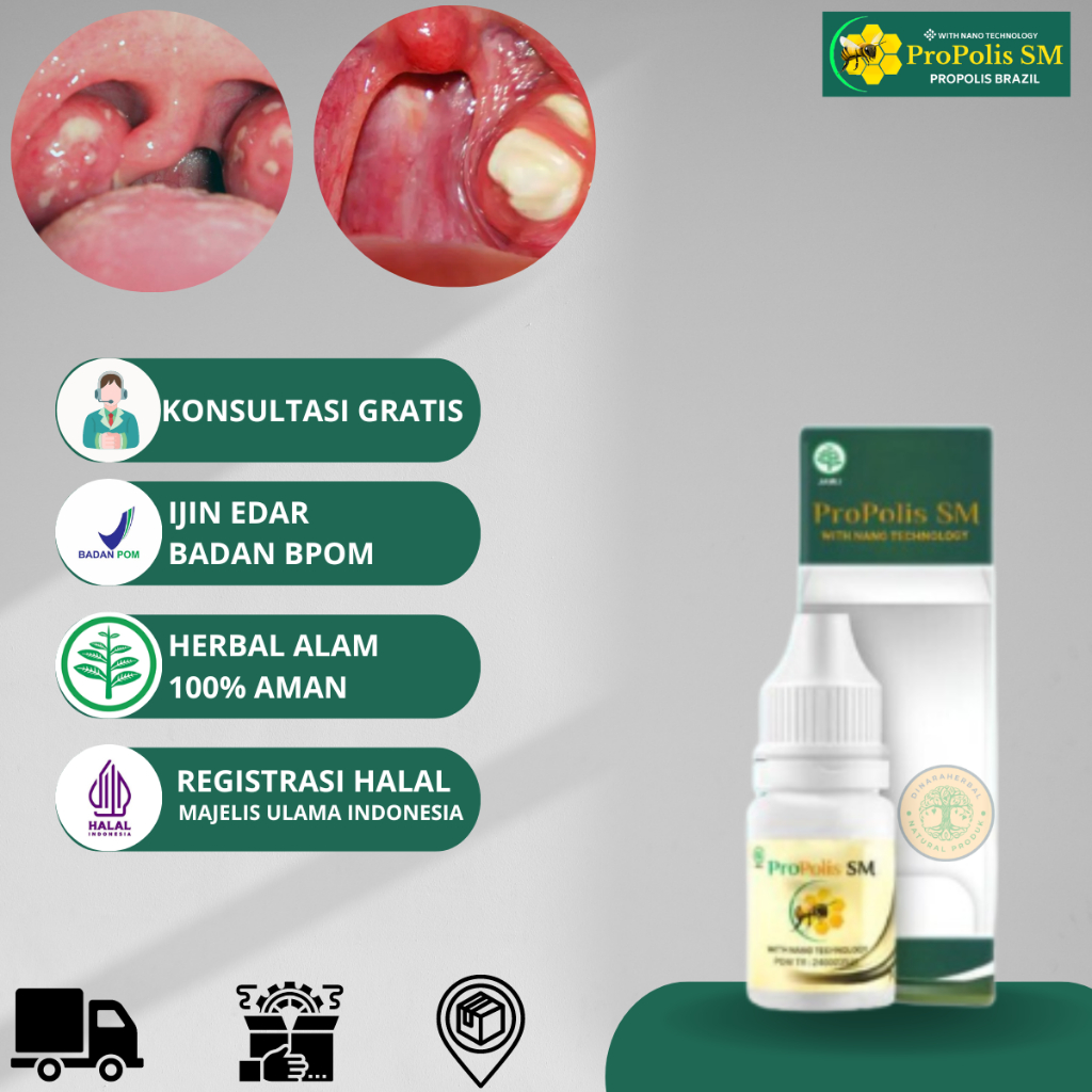 Obat Amandel Akut /Pengempes Amandel / Amandel Bengkak Sebelah Tonsil Akut Dan Kronis, Sakit Menelan