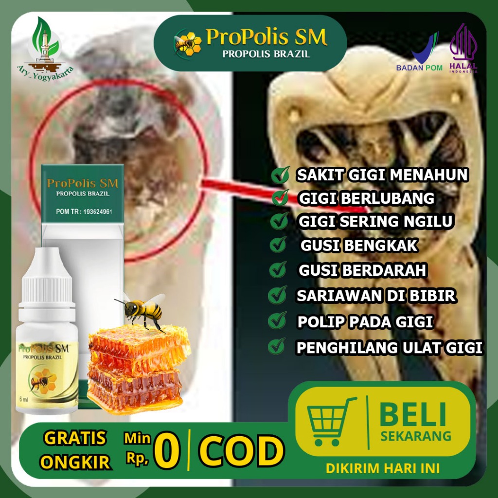 Obat Ulat Gigi Berlubang, Penghilang Ulat Gigi, Penghancur Ulat Gigi, Pembasmi Ulat Gigi Terlaris