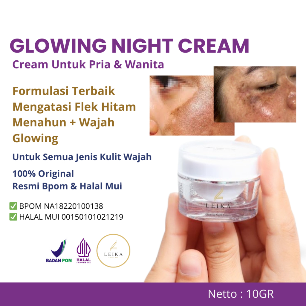 Penghilang flek hitam di wajah Krim Penghilang flek hitam Cream flek hitam membandel Menghilangkan F