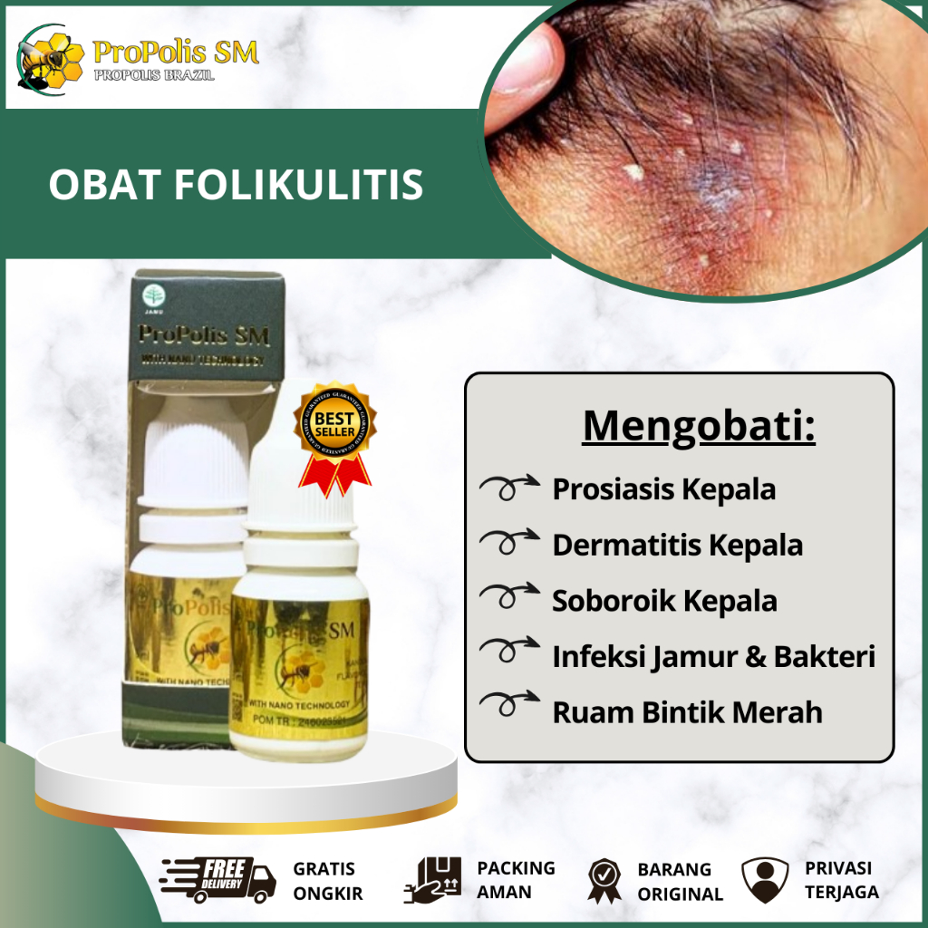 Obat Folikulitis Kepala Jerawat Jamur Nodul Kudis, Obat Gatal Kulit Kepala, Obat Psoriasis Kulit Kep